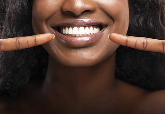 smile design