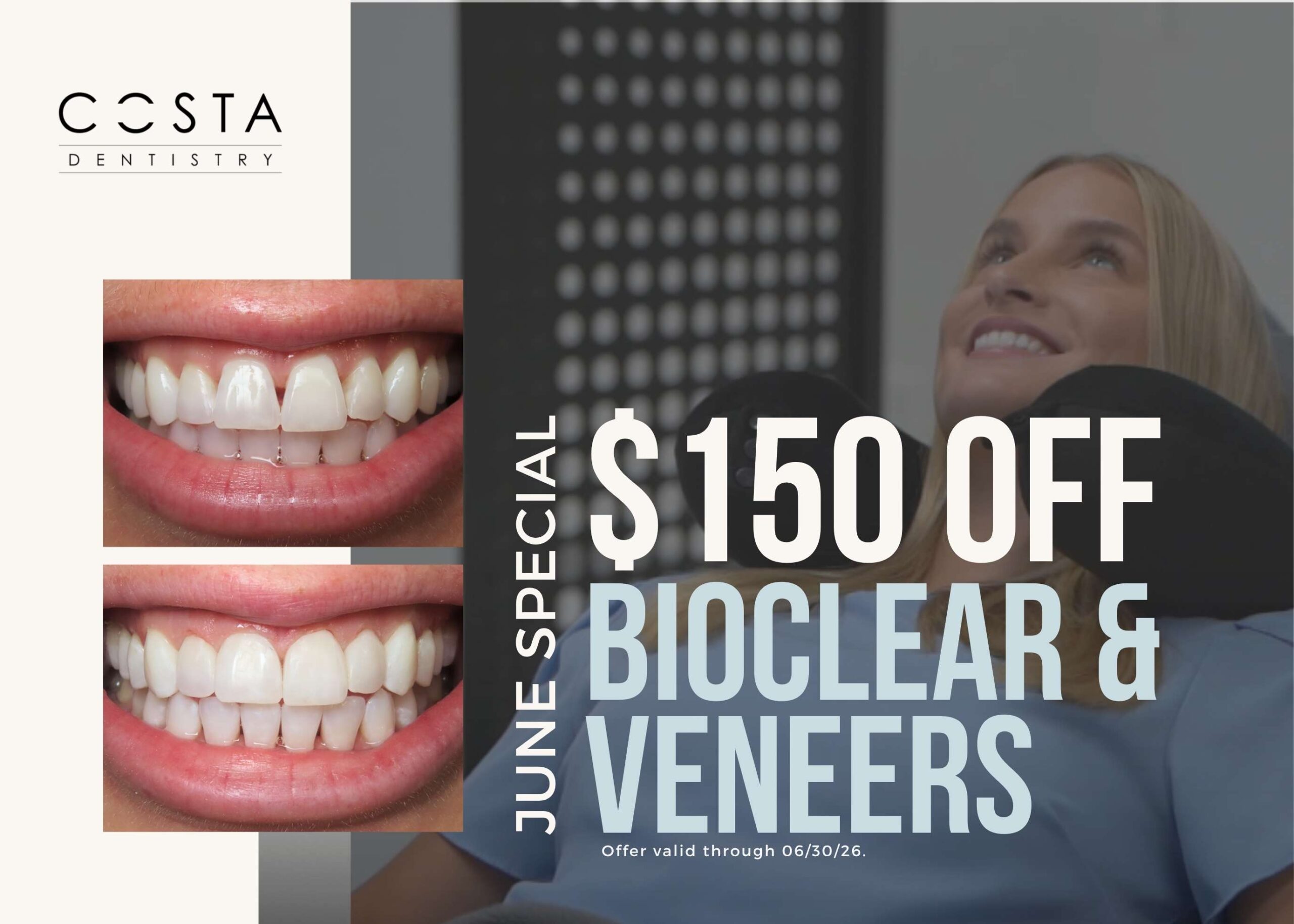 bioclear and veneers $150 off promotion flyer for month of June. Girl smiling