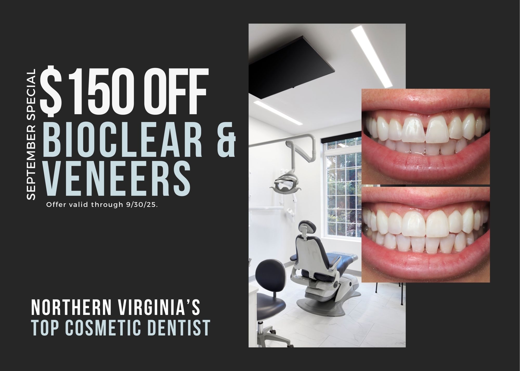 bioclear and veneers promotion card for $150 off treatment.